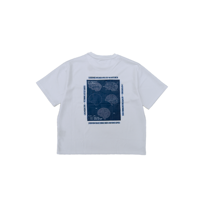 Koppich | The reconstruction | 01 TEE