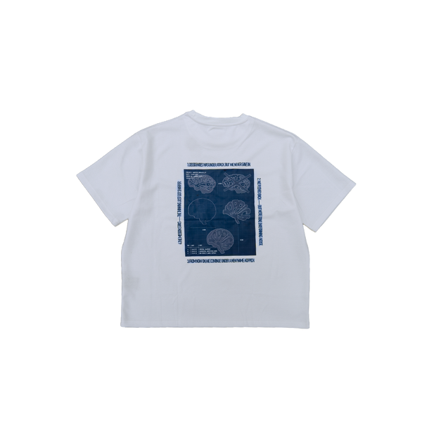 Koppich | The reconstruction | 01 TEE