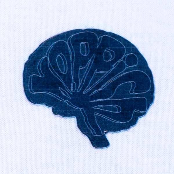 Koppich | The reconstruction | 01 TEE